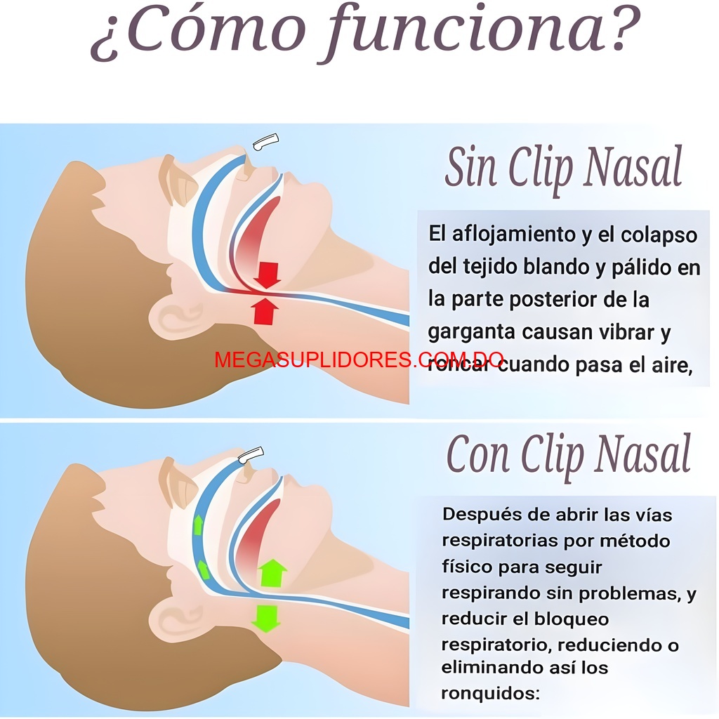  Clip Nasal Antironquidos – Ayuda para no Roncar y Dormir Mejor Foto 7304618-5.jpg