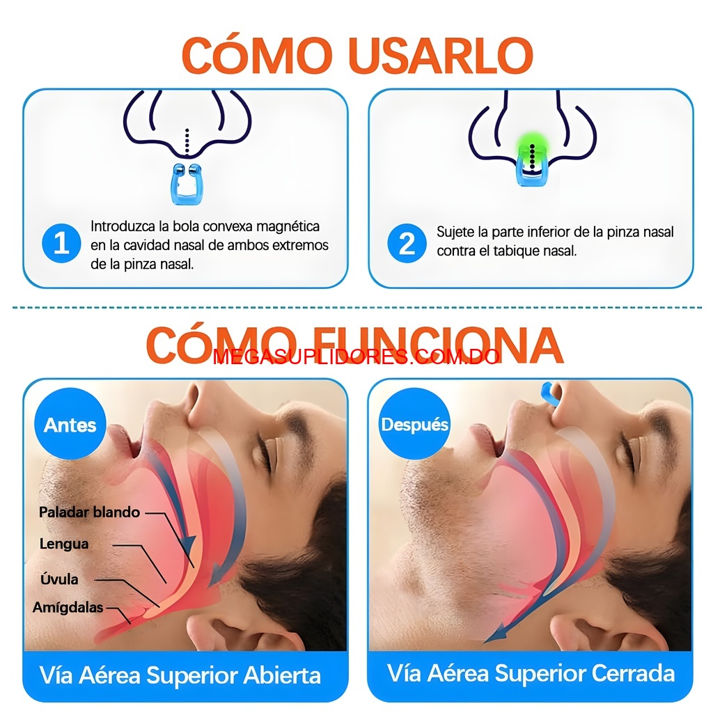  Clip Nasal Antironquidos – Ayuda para no Roncar y Dormir Mejor Foto 7304618-6.jpg