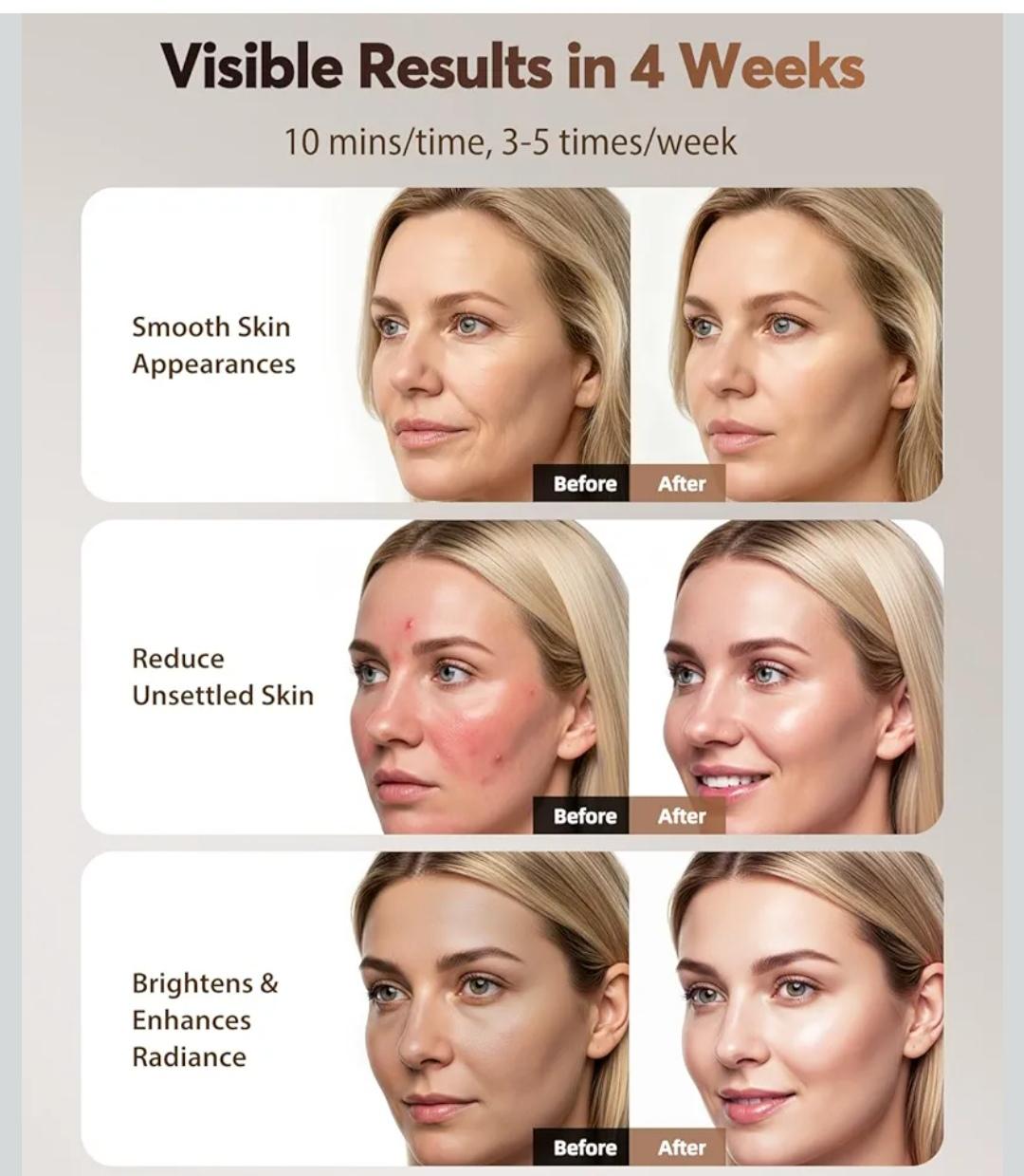 Máscara LED Facial Profesional Terapia de Fototerapia para Rejuvenecim Foto 7309647-7.jpg